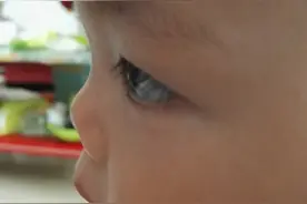 宝宝塌鼻子是发育不好吗？图片