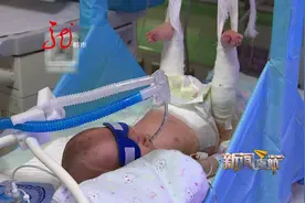 弃婴小蘑菇后续：孩子情况稳定 爱心不断汇聚视频封面