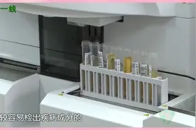 尿常规检查随便用什么时候的尿液都可以吗？医生：这个时间的最好视频封面