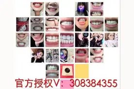 唯爱牙齿冷光美白仪:惊爆网红达人的秘密美牙神器!图片