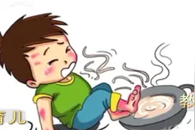 当火锅热汤泼向孩子，父母怎样把伤害降到最小？