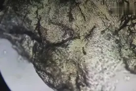 科普：显微下的鼻屎有多脏？掏完请洗手