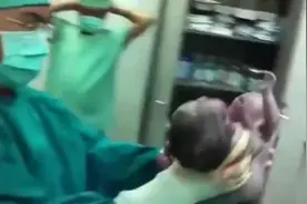 这对双胞胎宝宝一出生，把整个医院都惊呆了图片