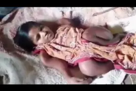 印度女子越长越矮！25岁身高竟从1.2米萎缩至0.6米！图片