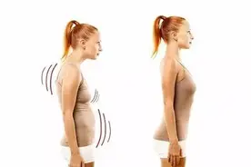 健身 | 如何矫正驼背？只要2个动作，挺身做人！图片