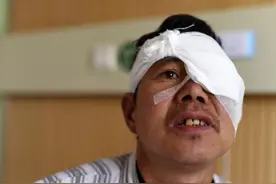 金寨13岁少年照顾失明父亲续：盲父已做复明手术图片