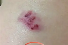 海口2只狗咬伤邻居 狗主人赔偿治疗费不愿将狗送走图片