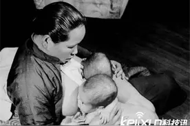 揭秘：上海1947年连体婴 竟然被如此处理图片