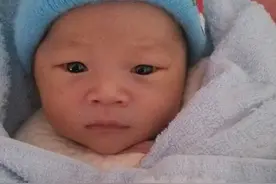 宝宝力气太大，奶头被吸破，现在竟然流出脓水！图片