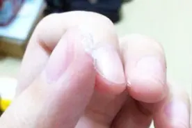 502胶水滴手上别着急！教你快速分离胶渍，简单方便不伤手视频封面