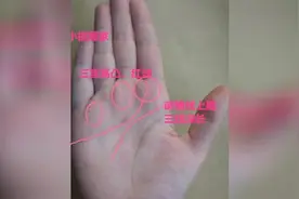 有凤眼手相是好事，若是凤眼封闭不全，纹线中断，身体必有病