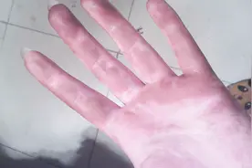 染发剂沾手上难清洗，农村小媳妇教你，用这2种日常垃圾5分钟搞定