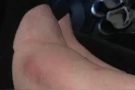 连线奚梦瑶：摔倒后脑子空白 脚再疼也要优雅走完图片