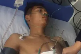 慎入！U17锦标赛惨剧，球员右腿双骨骨折图片