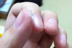 家居小常识 502胶水把手黏住了怎么办图片