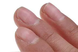 手指月牙关乎五脏健康，每天一碗，手指月牙回来了，白头发不见了图片