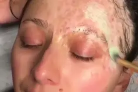 19岁女孩“烧伤”面目全非，学会化妆后，每天坚持，现在成了这样