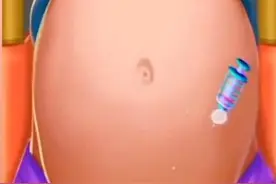 3D图模拟剖腹产手术全过程，看完之后许多男人都被感动了图片