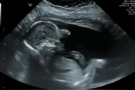 怀孕24周女宝宝胎动视频，宝宝在母体内动作优雅，妈妈好开心！