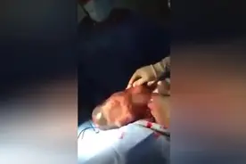 刚出生的宝宝还被胎膜包裹着，让人初次见­到不一样的生产过程图片