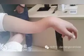 玩充气城堡，什邡女童手臂骨折摔成“波浪形”图片