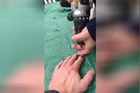 指甲淤血怎么办？这办法你敢试一试嘛？