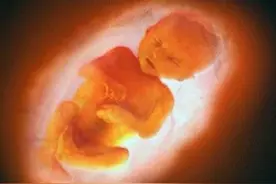 做四维彩超有什么好处， 那个时间段做是最佳图片