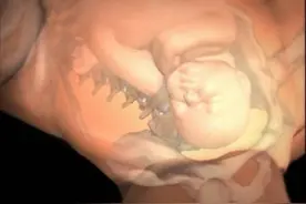 妈妈顺产全过程详解，相信你看完后会由恐惧变为期待！（多图）图片