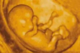 四维彩超对胎儿有影响吗？答案是有图片