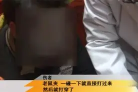 「惊险」建瓯男子抓老鼠竟然被送进医院，连消防官兵都来了图片