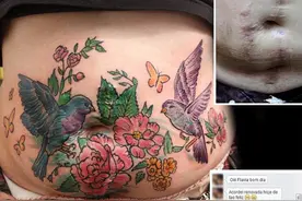 巴纹身师免费用图案为受伤女性遮盖伤疤图片