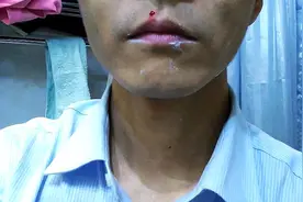男人没有选好它，就会破相图片