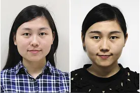 变小脸，就要快!准!狠!瘦脸针就是这个狠角色图片