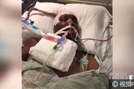 奥多姆随科勒上真人秀 病危抢救、康复画面曝光甘愿被“消费”图片