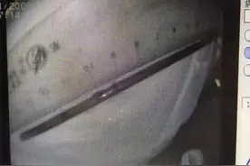 邵阳一男子模仿杂技表演，生吞16cm钢钉图片