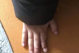 家中电插排存在大危险 徐州一幼童手伸进插孔被电伤图片