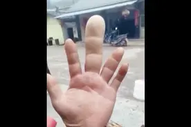 男子拥有一根巨无霸中指！