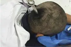 女孩被飞镖插后脑 银色飞刀长约15厘米写有小李飞刀字样图片