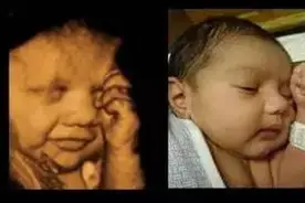 四维彩超太神奇了，出生后对比超级像，简直萌萌哒~~图片