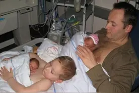 丹麦好哥哥抱早产弟弟 身贴身传递温暖图片