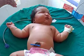 印度南部诞生一名女婴 或成为“世上最重女婴”图片