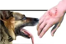 潜江2岁幼童被狗咬，打过疫苗仍死亡！这个病致死率100%图片