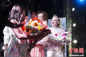 津巴布韦首届白化病人选美比赛 22岁女孩夺冠图片
