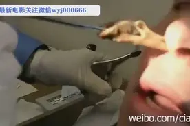 史上最大鼻屎！扯出来的那一刻太爽啦！