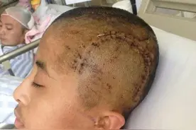 宿舍睡觉打呼被打 宿舍舍友睡觉打呼噜怎么办？图片