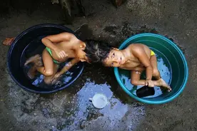 菲双胞胎姐妹头顶相连 若手术分离其中一人须牺牲图片