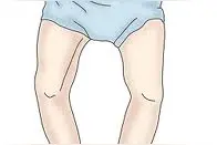 四个小窍门矫正O型腿图片