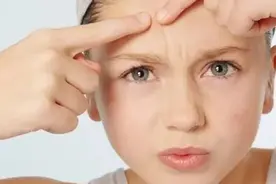 脸上长痘竟是这些原因图片