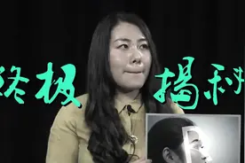 医学专家告诉你：为什么就你拍照丑图片