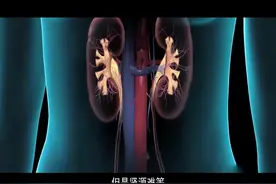 尿毒症患者福音：“人工肾”即将上市，告别透析指日可待！